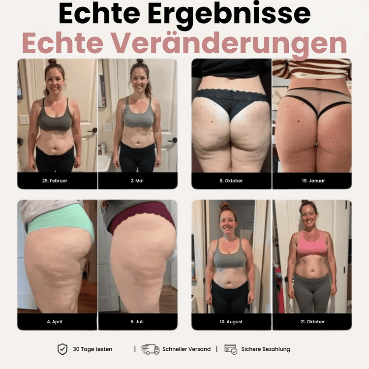 3D Skinora Leggings – Definiere deine Silhouette mühelos neu