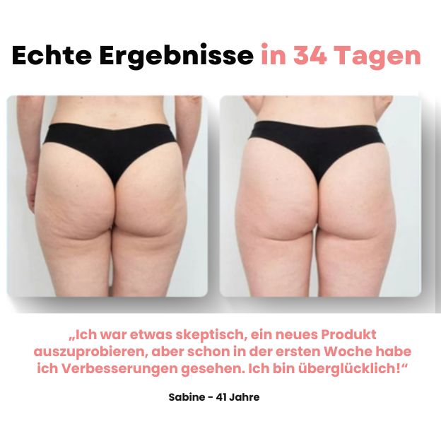 Skinora™ - Anti-Cellulite-Massagegerät