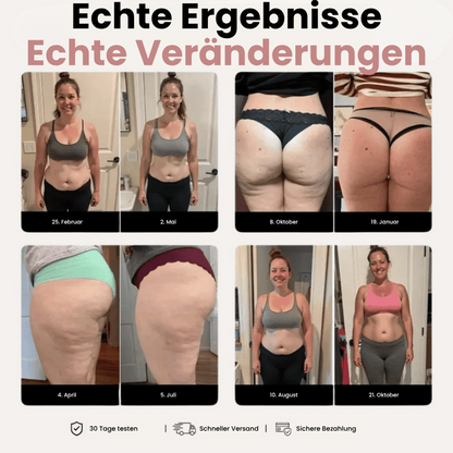 3D Skinora Leggings – Definiere deine Silhouette mühelos neu